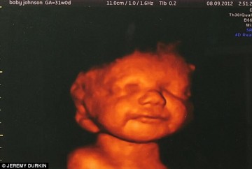 Baby Lucian ultrasound
