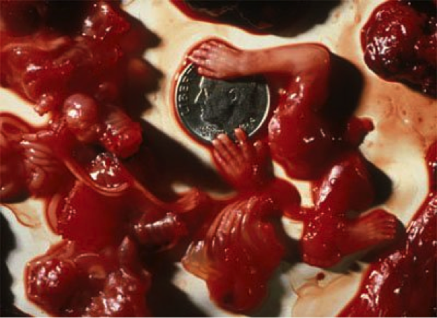 abortion photo 7
