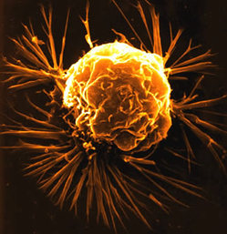 breast-cancer-cell.jpg