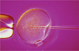 egg-donor.jpg