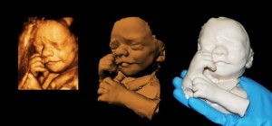 26-weeks_feto-3D-620x290
